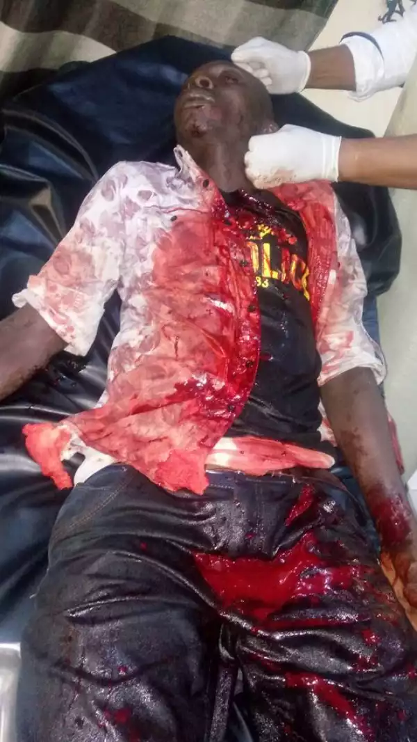 Ijaw Youths Attacked In A Hotel In Bayelsa While Sharing Money At An Event. Graphic Photos